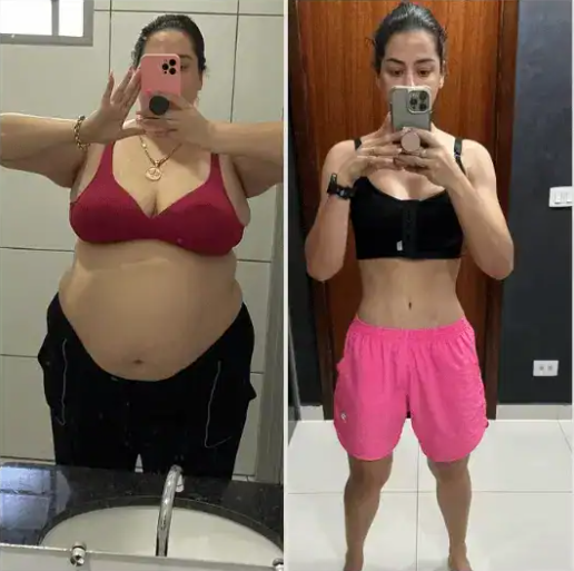 Vorher Nachher Susan