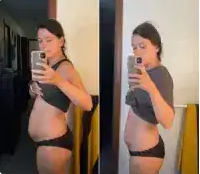 Vorher Nachher Laura